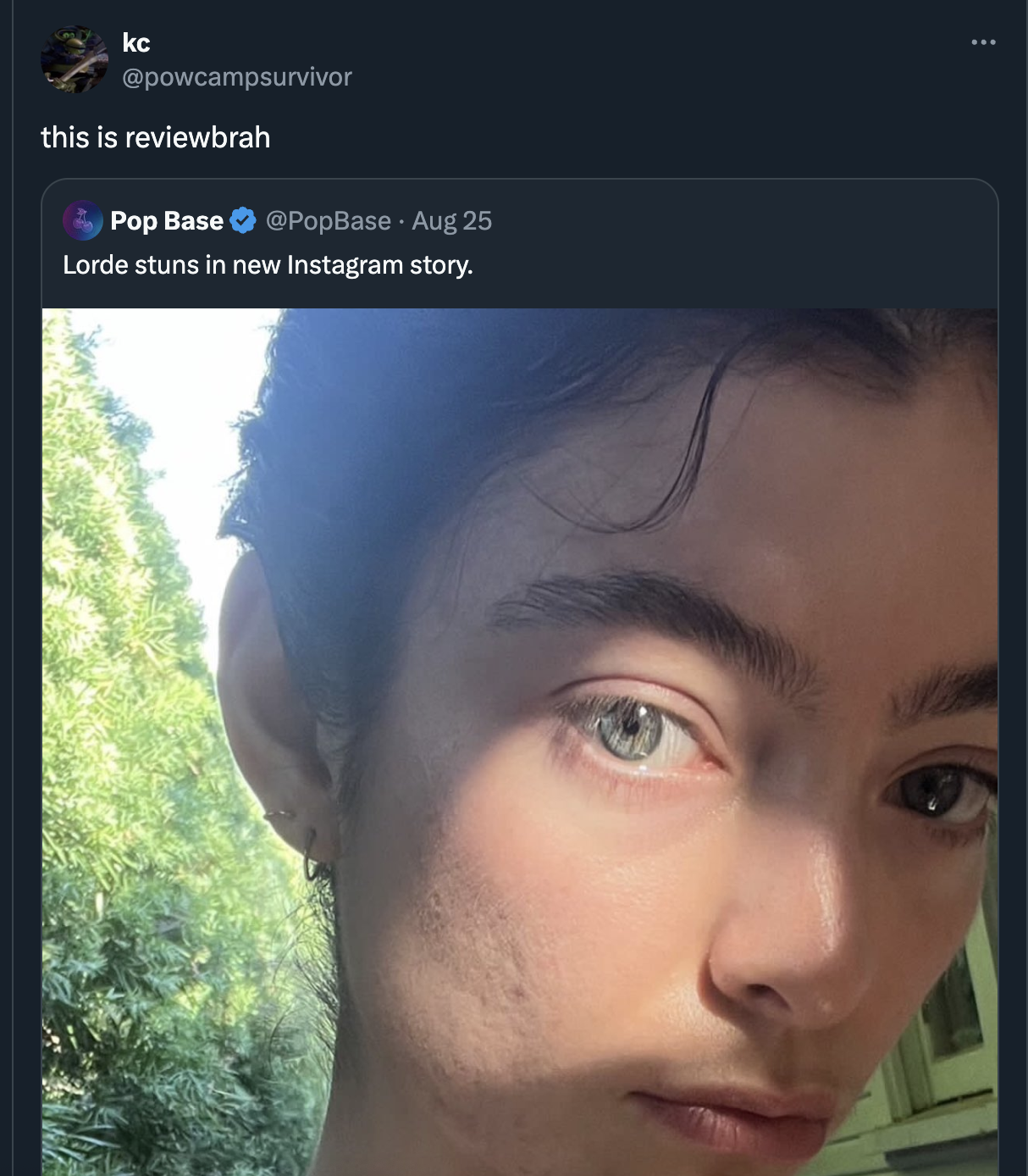 Acne scarring - kc this is reviewbrah Pop Base Aug 25 Lorde stuns in new Instagram story.